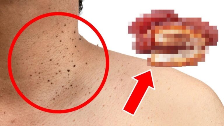 Diese einfache Veränderung in deiner Ernährung könnte erstaunlich gegen Hautporen wirken…