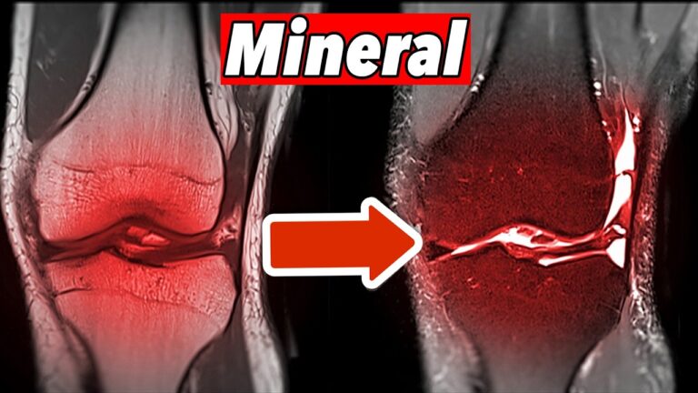 Verliere nicht dein Gelenk: 5 Schritte, um Knorpelverlust durch Mineralmangel zu stoppen!