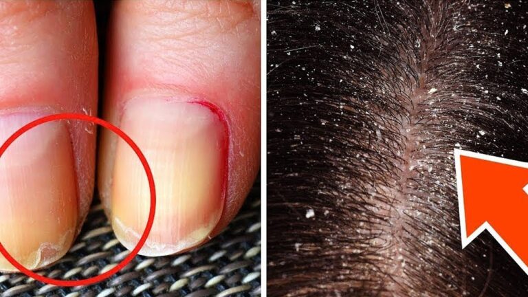 8 Anzeichen für Omega 3 Mangel – Erkenne sie jetzt und handle sofort!