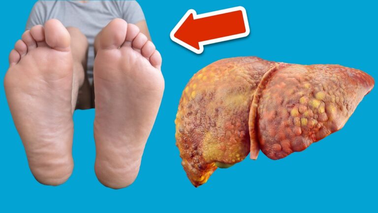 7 überraschende Hinweise, dass deine Leber Hilfe braucht – Haut & Füße beachten!