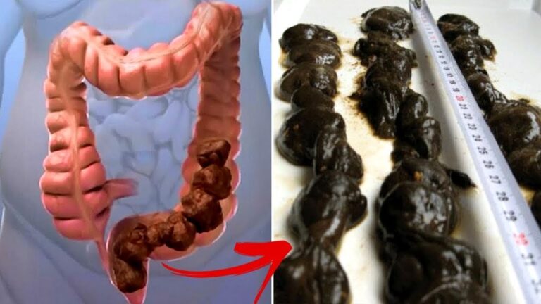 7 bewährte Methoden zur schnellen Darmreinigung für mehr Wohlbefinden