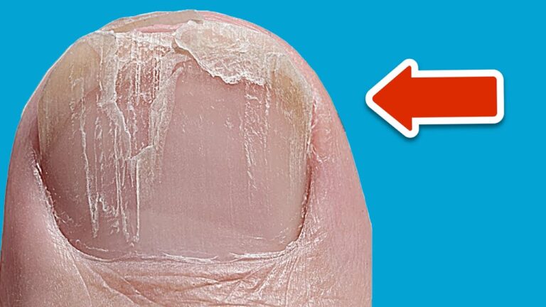 5 erstaunliche Fakten: Was deine Nägel über deine Gesundheit aussagen!