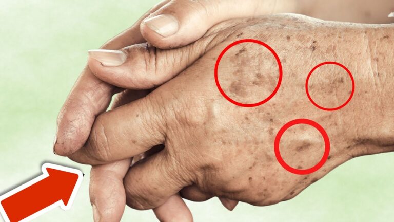 7 geheime Lebensmittel für strahlende Haut ohne Altersflecken über Nacht!